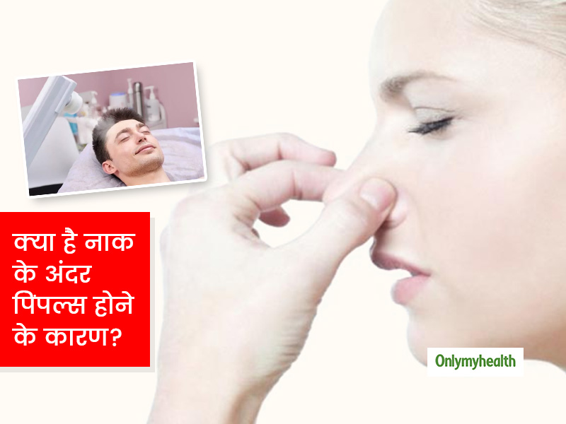 नाक के अंदर क्यों हो जाते हैं फुंसी या पिंपल्स? जानिए इससे छुटकारा पाने के घरेलू उपाय
