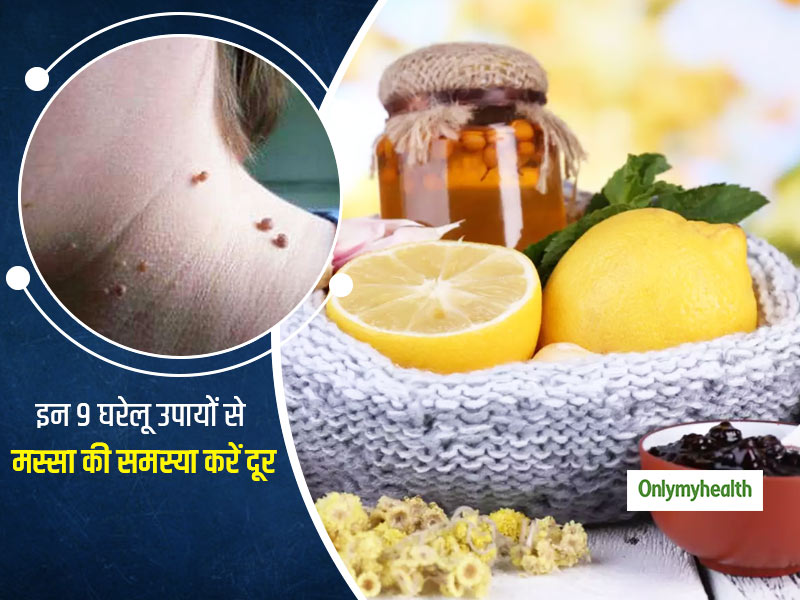 Skin Tags: गले, हाथ या चेहरे पर मस्सों से हैं परेशान? जानें मस्सों को हटाने के लिए 9 घरेलू उपाय