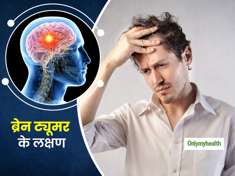 इन 5 तरह के सिर दर्द को न करें नजरअंदाज क्योंकि हो सकते हैं ब्रेन ट्यूमर का संकेत, डॉक्टर से जानें अन्य लक्षण