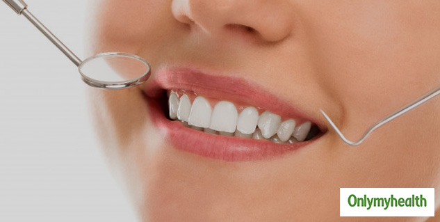 home remedies of yellow teeth