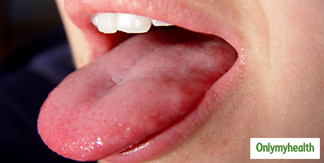 insideswellingintongue