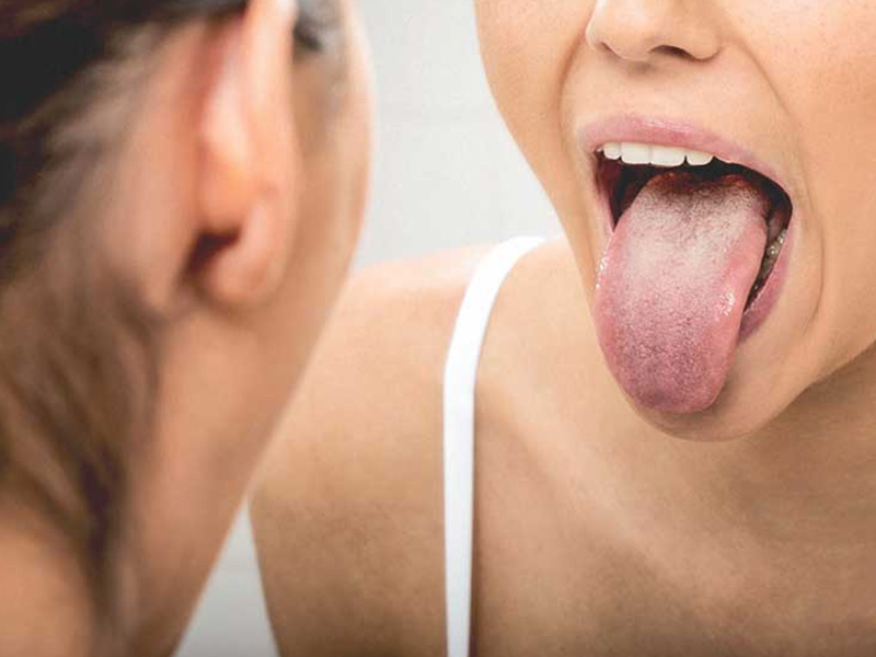 Choking tongue