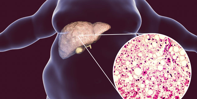 िोूूब तगनाी