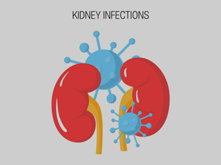 10 Home Remedies To Prevent and Manage Kidney Infection