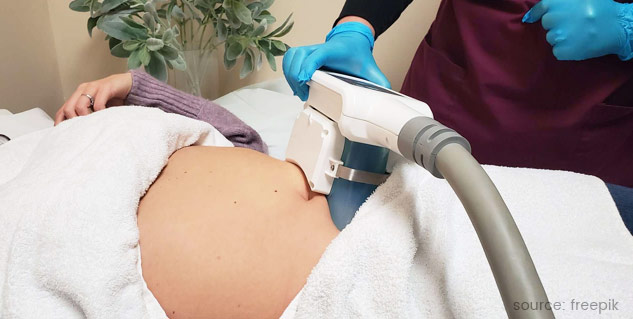 Inside2Coolsculpting