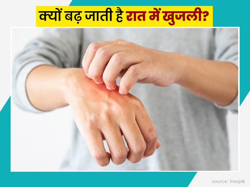 सोते समय आपके शरीर में भी बढ़ जाती है खुजली? जानें इसके 7 कारण और दूर करने के उपाय