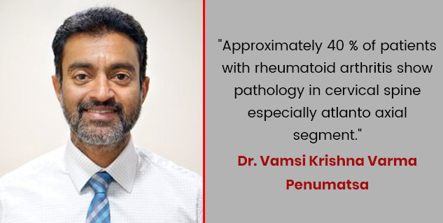 Rheumatoid Arthritis