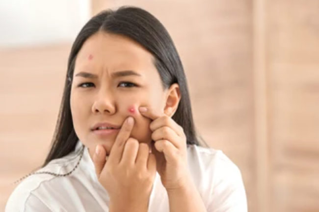फोड़े को पकाकर बहाने के घरेलू नुस्खे