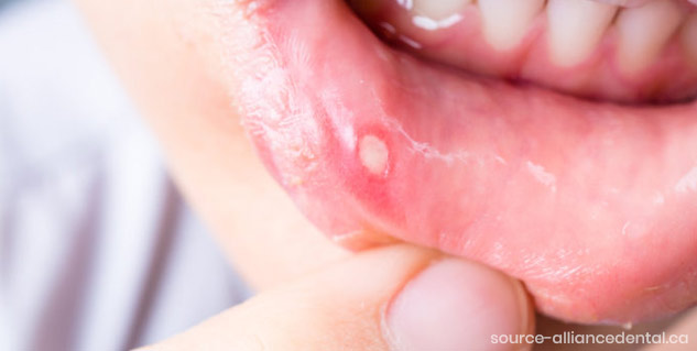 Inside3_kuthbenefits