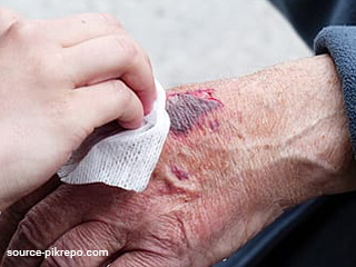 चोट या सर्जरी के बाद घाव को जल्दी सुखाने के लिए खाएं ये 9 फूड्स, इंफेक्शन का खतरा भी होगा कम