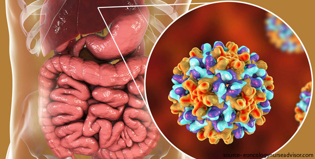 Diabetes and Hepatitis C