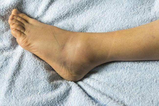 सूजन को कम करने में मददगार