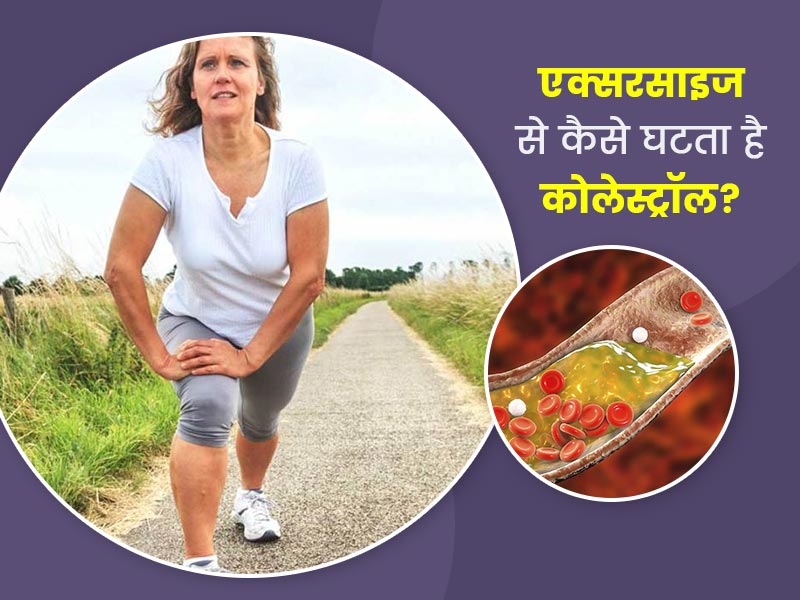 कोलेस्ट्रॉल घटाने में कैसे मददगार है एक्सरसाइज? जानें इसके लिए कौन सी एक्सरसाइज कर सकते हैं आप