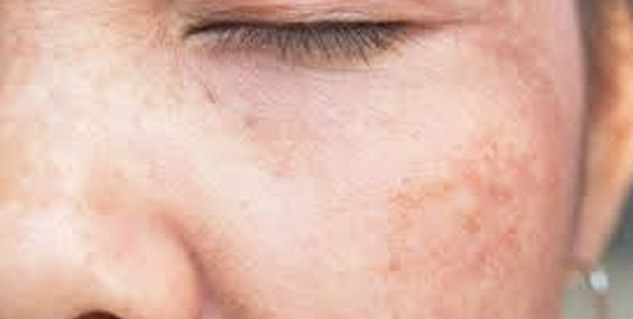 Inside4_CCcreambenefits