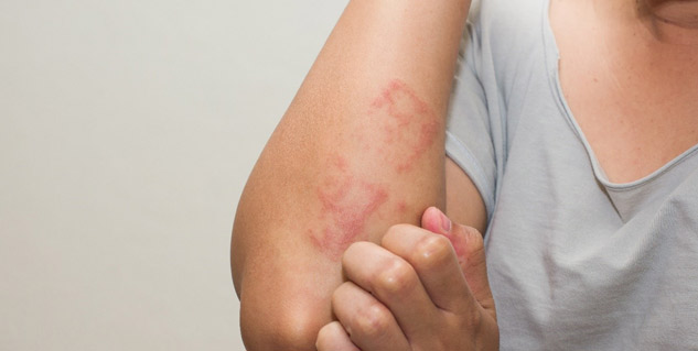 Inside1hives