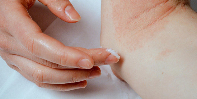 Banyan Tree Good For Healing