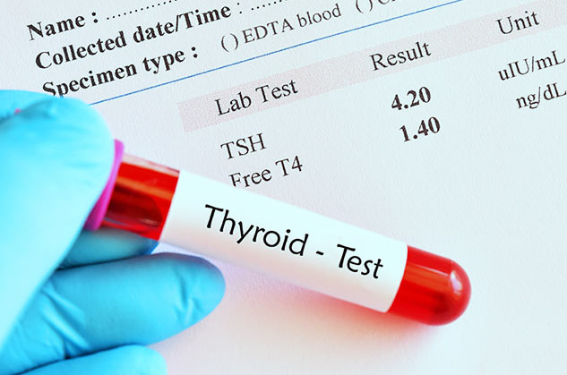 thyroiid test