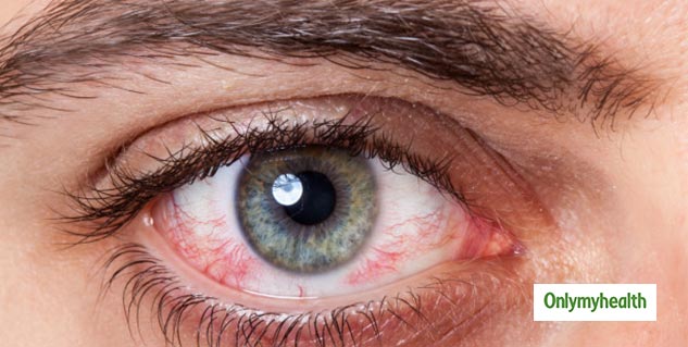 eye disorder symptoms