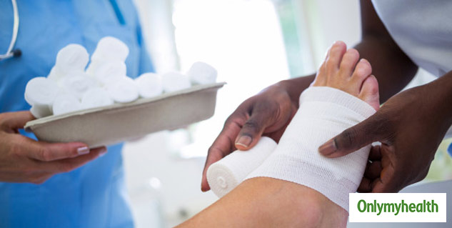 treatment of lump in leg