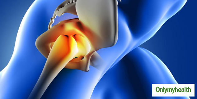 treatment of pain in hips