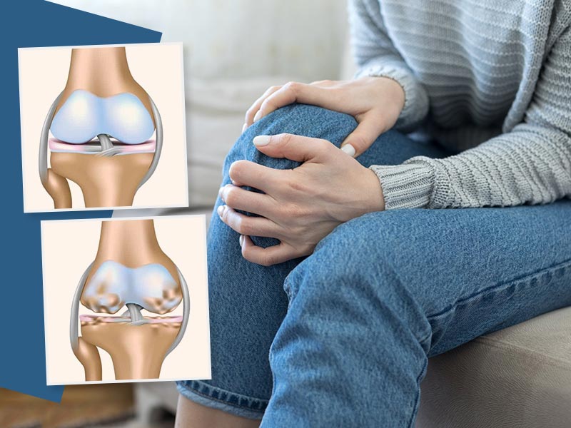 Degenerative Knee Problems Rising In Younger Adults, Are You At Risk? Let’s Find Out