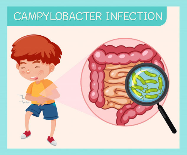 campylobacter infection