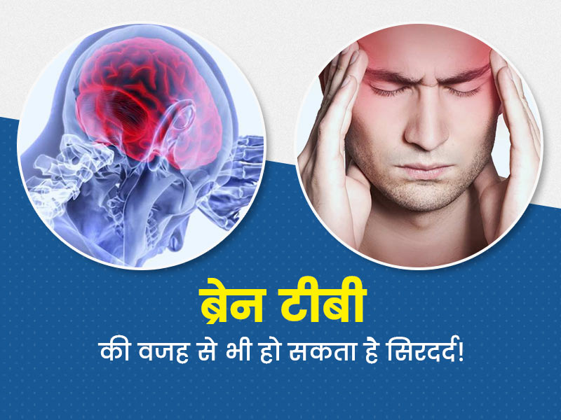 सिरदर्द, उल्टी जैसे सामान्य संकेतों से शुरू होता है ब्रेन टीबी, डॉक्टर से जानें इसके लक्षण, कारण और इलाज