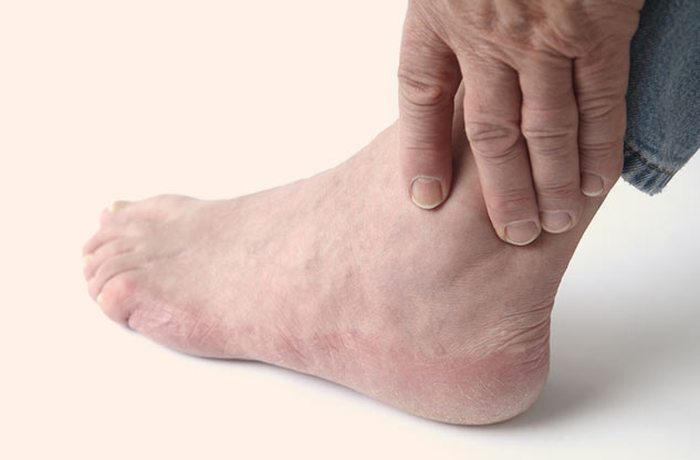 horstail inflammation