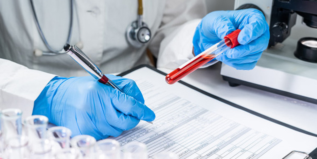 d-dimer test for corona