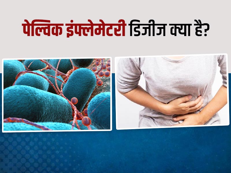 महिलाएं पेट के निचले हिस्से में दर्द को न करें नजरअंदाज, कहीं आप तो नहीं इस गंभीर बीमारी के शिकार