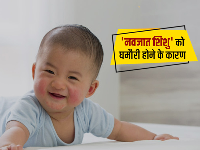 गर्मी में शिशुओं को घमौरी होने के 7 कारण और उपचार