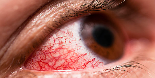 Inside3_conjunctivitisandcovid