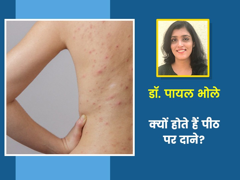 पीठ पर दाने निकलने का कारण और इलाज