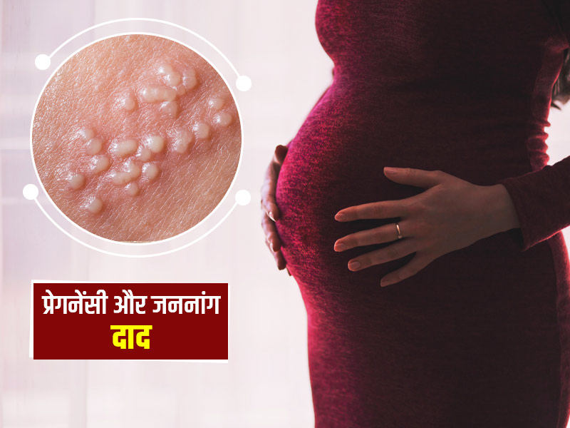 प्रेगनेंसी में जेनिटल हर्पीज के कारण, लक्षण और बचाव