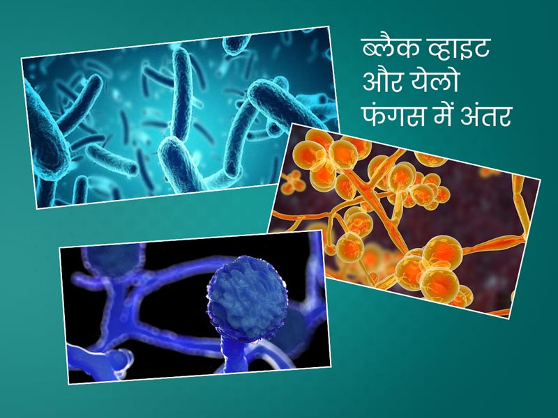 ब्लैक फंगस, व्हाइट फंगस और येलो फंगस में क्या है अंतर? जानें डॉक्टर से