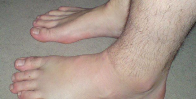 swellin