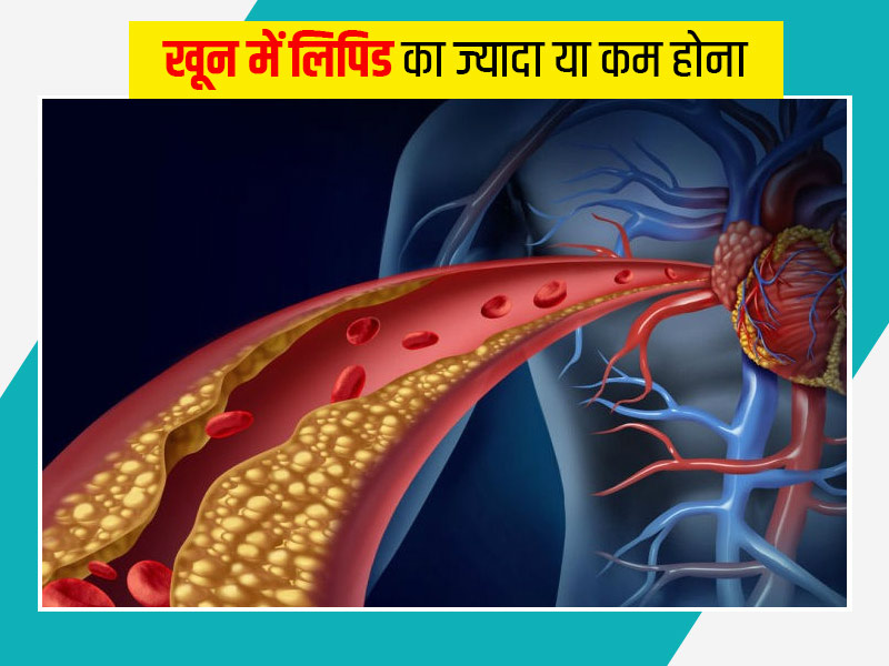 खून में लिपिड का स्तर बढ़ने या घटने का क्या मतलब है? जानें इसके लक्षण, कारण और इलाज