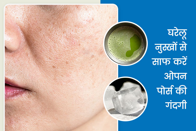 ओपन पोर्स से गंदगी निकालने के घरेलू नुस्खे