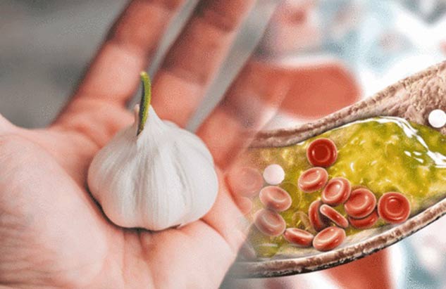 garlic-for-bad-cholesterol