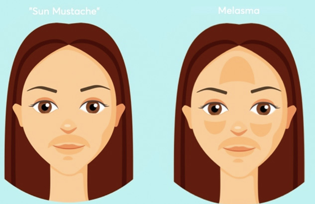 sun-mustache-remedies-inside2