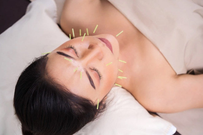 Benefits of acupuncture therapy