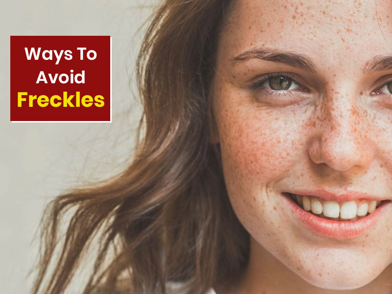 Freckles Prevention Tips: Here’s How You Can Prevent These Beauty Spots