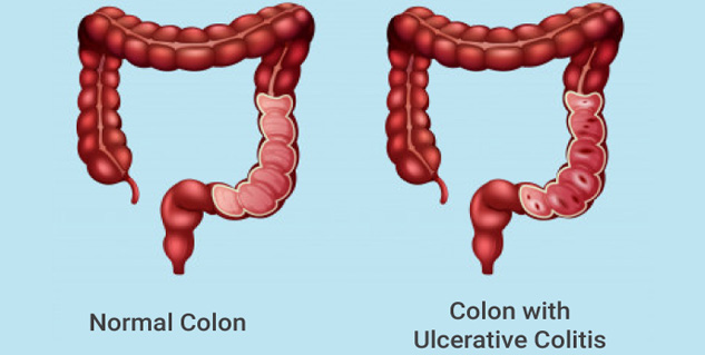 Insidecolonuc