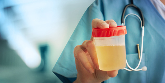 Cloudy-Urine-Foods-Drinks