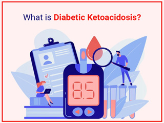 What Is Diabetic Ketoacidosis? Signs, Causes, Treatment & Prevention