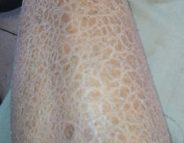 fish scales