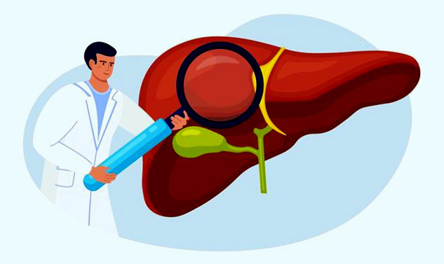 Non-Alcoholic-Fatty-Liver-Disease