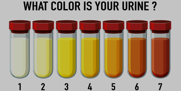 Urine Blood