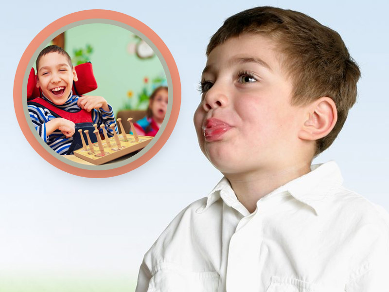 World Cerebral Palsy Day 2021: बच्चों में सेरेब्रल पाल्सी के लक्षण, कारण और बचाव के उपाय