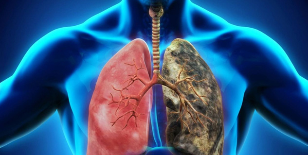 lung infection